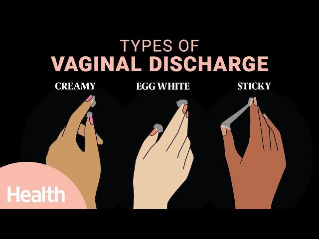 What Vaginal Discharge Says About Your Health | Deep Dives | Health
