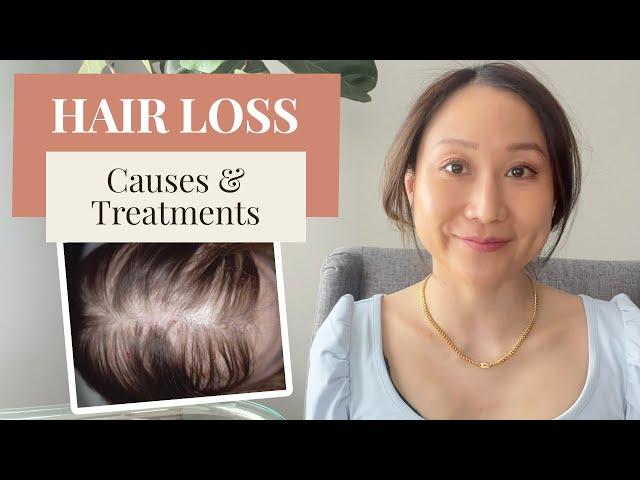 Dermatologist Shares Hair Loss Causes and the Ways to Treat and Prevent it