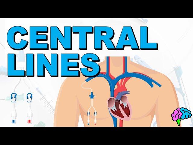 The Basics of Central Lines - Central Venous Catheters (CVC)