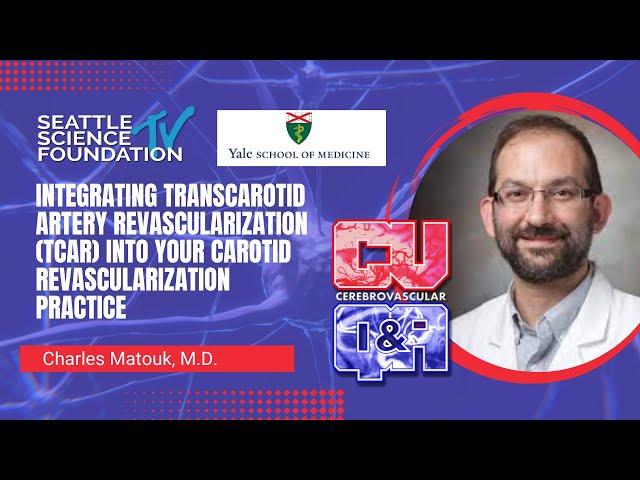 Integrating Transcarotid Artery Revascularization (TCAR) - Charles Matouk, MD