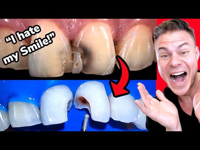 Real Orthodontist Reacts! Crazy Dental Transformation Makes Patient Smile Again!