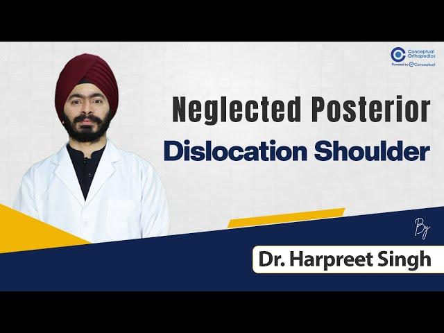 Neglected Posterior Dislocation shoulder by Dr. Harpreet Singh | Orthopedic Residency