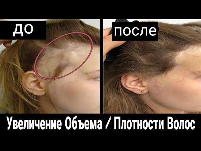 Быстро От Тонких До Толстых Волос |  Причины Низкой Густоты Волос