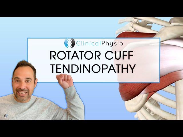 Rotator Cuff Tendinopathy | Expert Explains Mechanism Of Injury and Rehab Plan