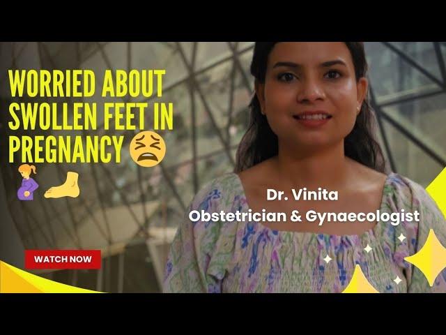 Swollen feet in pregnancy! Dr. Vinita @Obstetrician-Gynaecologist