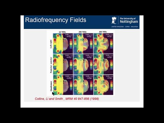 ISMRM MR Academy - Side Effects of High Magnetic Fields