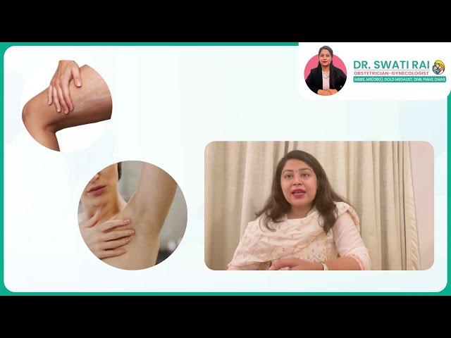 Symptoms of PCOS by Dr. Swati Rai