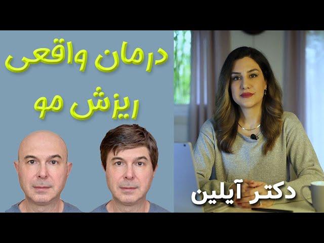 درمان سریع ریزش مو مردان و زنان با دکتر آیلین  _ dr aylin