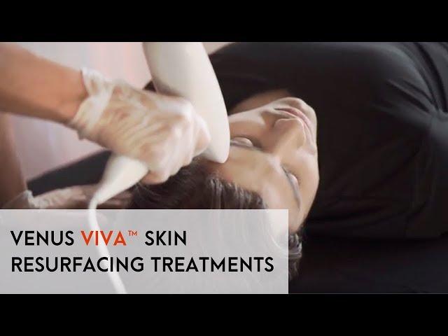 Venus Viva™ Skin Resurfacing Treatments