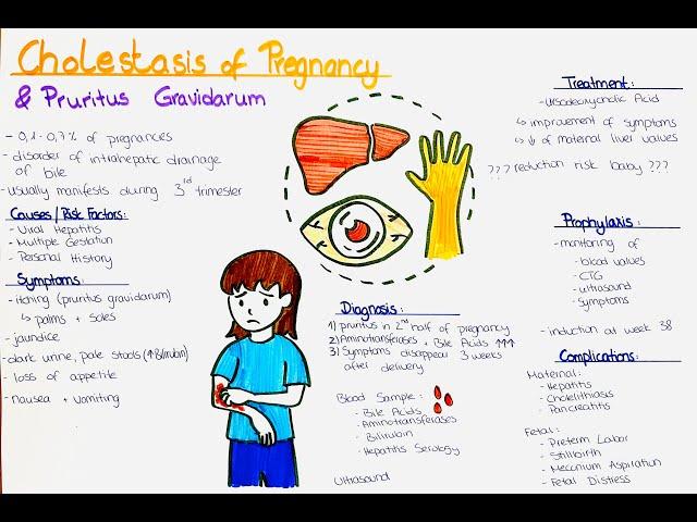 Cholestasis of Pregnancy + Pruritus Gravidarum - Causes, Symptoms, Diagnosis, Treatment, Prophylaxis