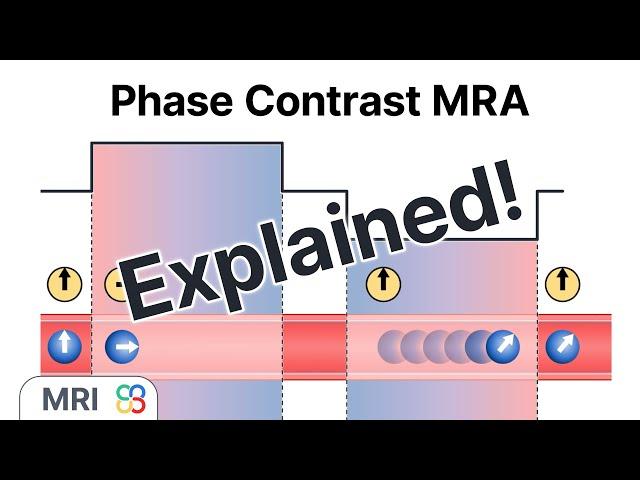 What is Phase-Contrast Magnetic Resonance Angiography (MRA)? - MRI explained