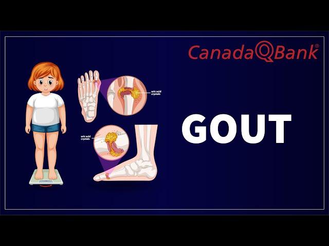 Gout