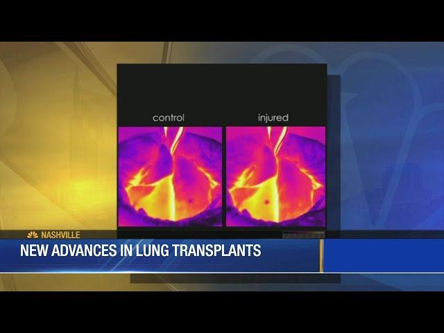 Major lung disease breakthrough at Vanderbilt