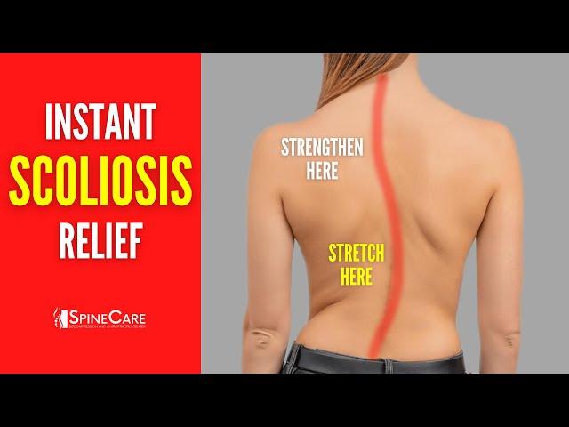 Best Scoliosis Exercises for Pain and Posture (NO EQUIPMENT!)