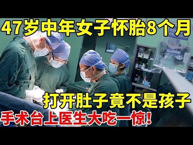 2024最新｜47岁女子怀孕8个月!肚大如球,打开肚子竟不是孩子,手术台上医生大吃一惊【生命缘】