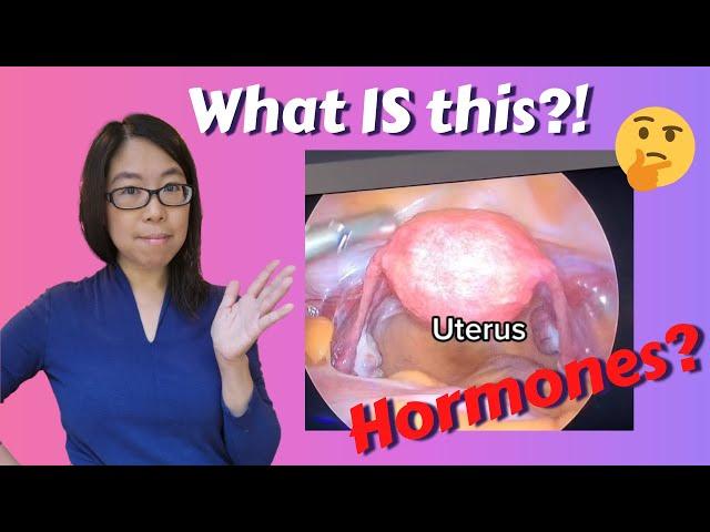 Everything HYSTERECTOMY - Gynecologist answers all your questions!