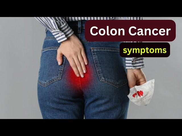 Colon Cancer Symptoms: What You Need to Know