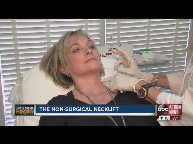 The non-surgical necklift