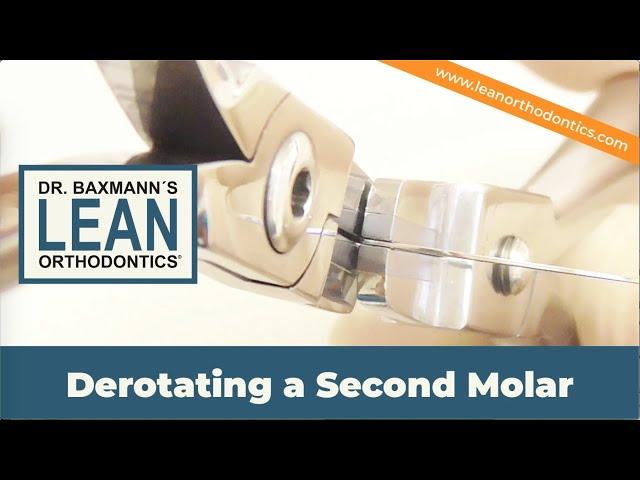 Derotating a Second Molar