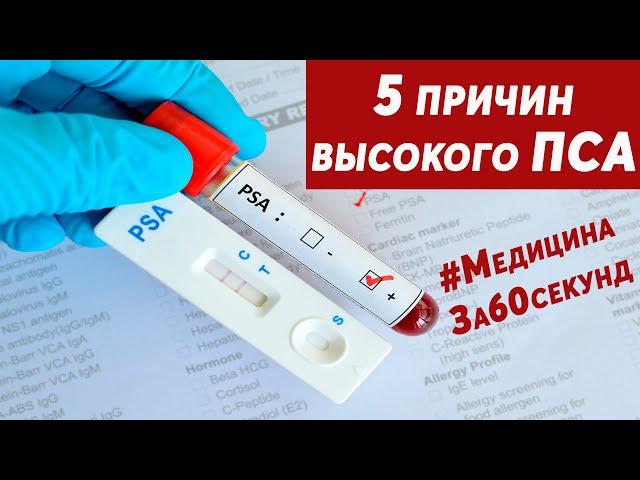 Причины высокого ПСА | Почему повышается ПСА? | Что такое ПСА? | #МедицинаЗа60секунд