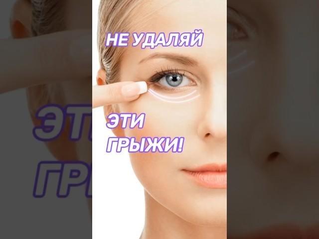 Как убрать мешки под глазами?