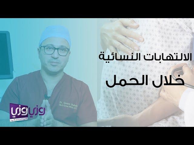 الالتهابات النسائية خلال الحمل