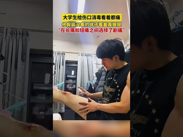 大學生給傷口消毒看着都痛，他假裝沒事的樣子看着真狼狽，“在長痛和短痛之間選擇了劇痛”