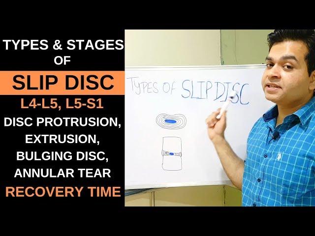 Stages of Lumbar Disc Herniation, Bulging disc L4-L5-S1, Herniated Disc Types, Disc Protrusion