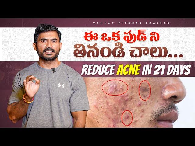 SAY GOODBYE TO Acne IN 21 DAYS WITH THIS FOOD || How to Get Rid of Acne in Telugu