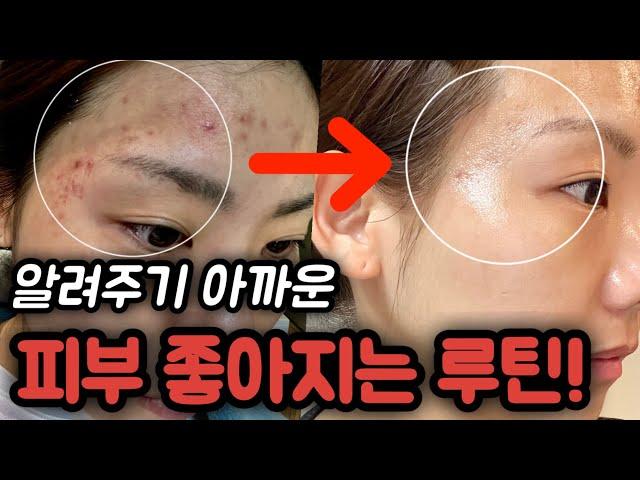 초고속내일 당장 피부 좋아집니다. 100% 효과보는 인생템 노하우 공개