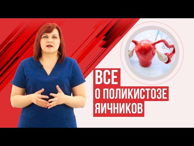 Поликистоз яичников. Синдром поликистозных яичников. СПКЯ