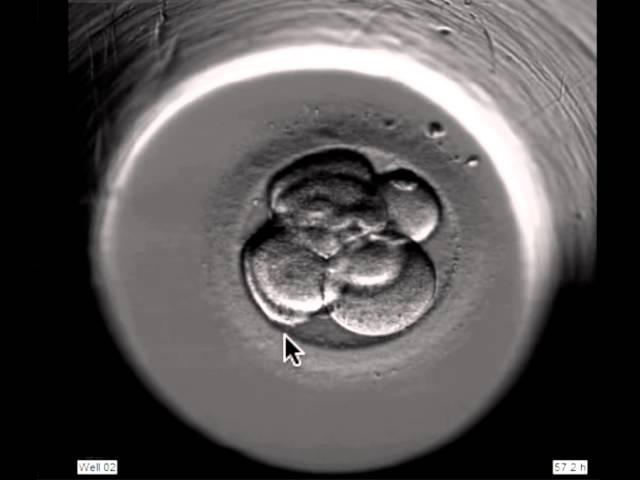 ivf embryo developing over 5 days by fertility Dr Raewyn Teirney