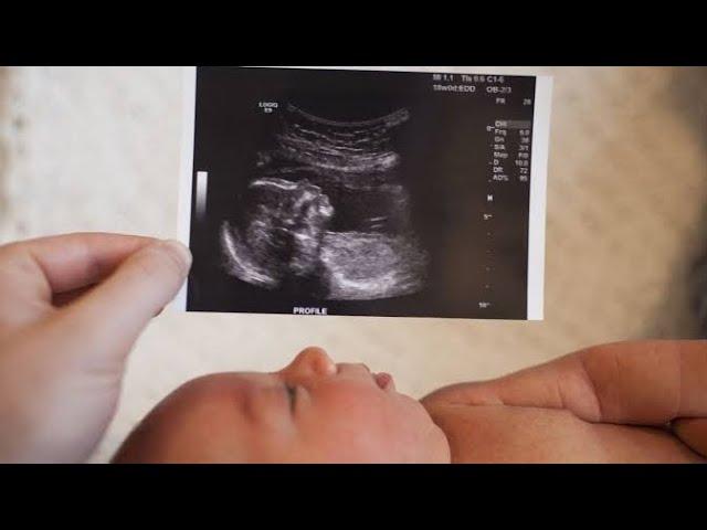 ultrasound of fetus | a baby boy | measurement Age of fetus | breech | doppler ultrasound | blood fl