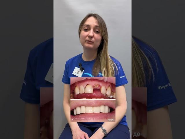 Шибаева Дарья Андреевна, стоматолог-ортопед стоматологии Super Smile
