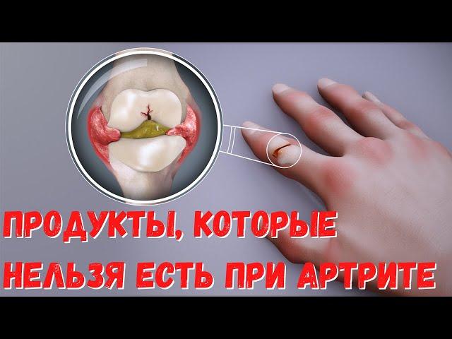 Какие продукты нельзя есть при артрите