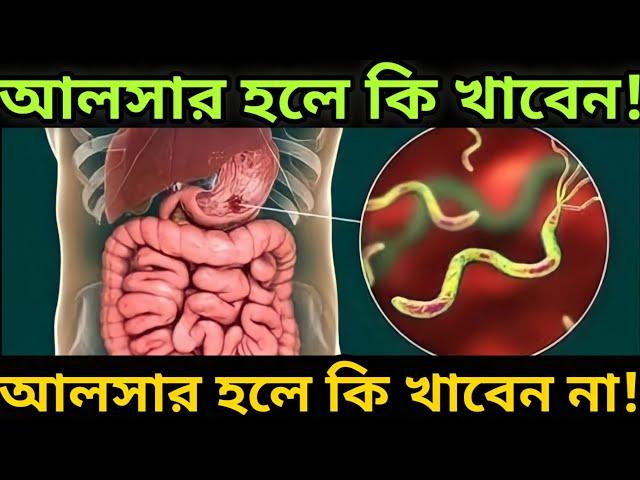 আলসার রোগের কারণ ও লক্ষণ | আলসার হলে কি কি খাওয়া যাবে ও কি কি খাওয়া যাবে না | আলসার রোগীর খাবার |