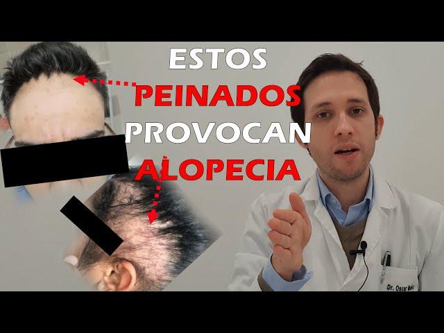 DOCTOR te cuenta PEINADOS que dan ALOPECIA