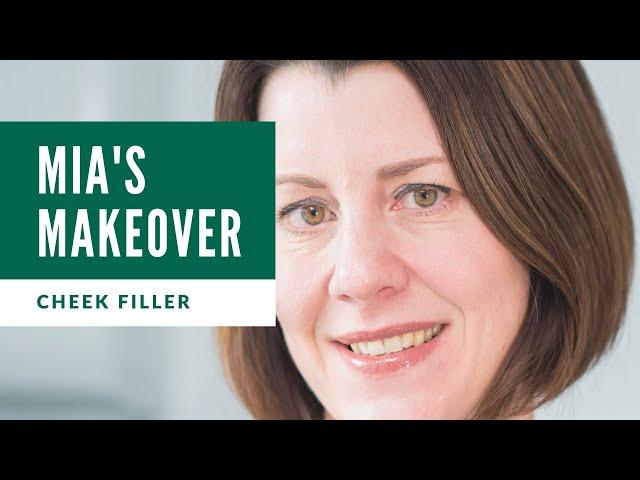 Mia's Makeover with Juvederm -  Cheek Filler | Cosmetic Courses