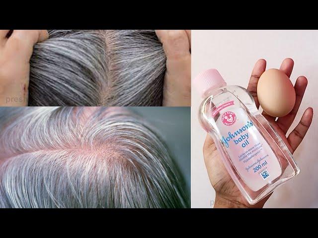 Gray hair turns black naturally permanently | From white hair to black hair in medicine