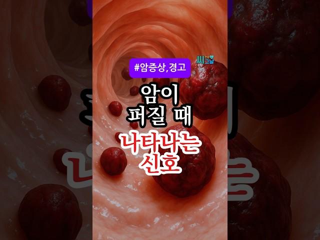 암이 퍼질 때 나타나는 신호 5가지, 절대 무시하지 마세요! #건강정보 #건강