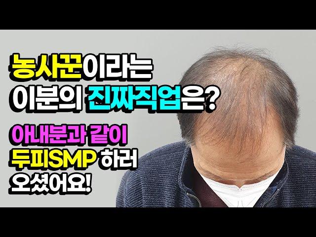 삭발 안하고 두피문신 해야하는 직업도 있지요~고객맞춤형 SMP디자인과 앞머리, 정수리 밀도