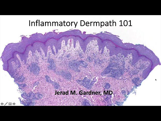 Inflammatory Dermpath 101 (A Beginner's Guide to Diagnosing Skin Rashes for Non-Dermatopathologists)