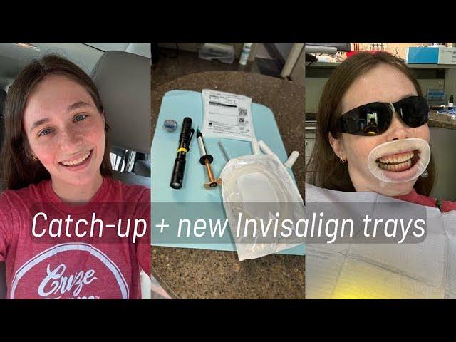 DAY IN THE LIFE: catching up, major Invisalign update, new trays?