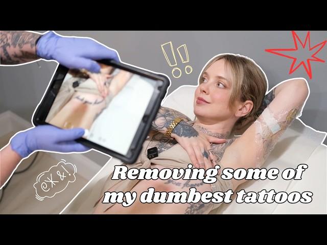 Removing MULTIPLE tattoos (and some of my dumbest) at Atlantic Laser in Virginia Beach