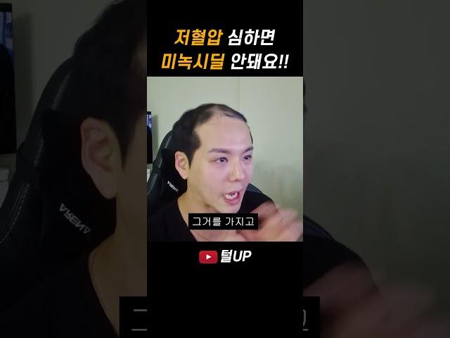 미녹시딜 이건 꼭 체크하고 사용하세요  #가발 #탈모