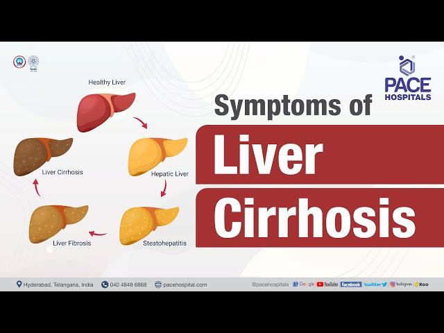 What are the symptoms of Liver Cirrhosis? | PACE Hospitals #shortvideo  #livercirrhosis