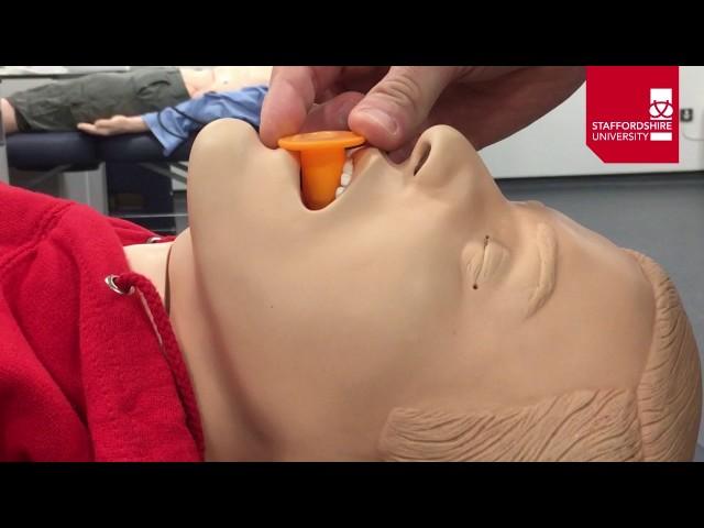 Oropharyngeal Airway Insertion