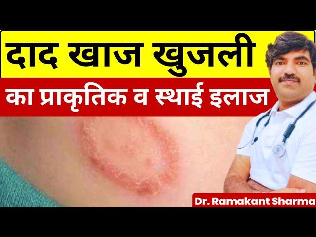 दाद, खाज, खुजली से छुटकारा पाएं | fungal skin infection@dr.ramakantsharma7