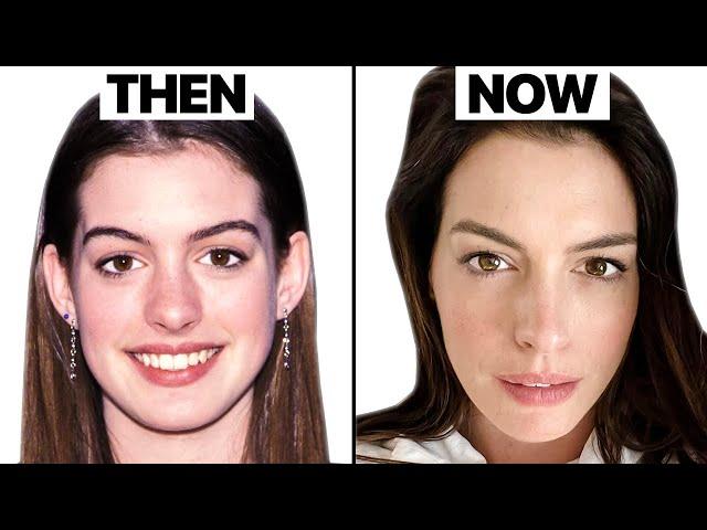 Truth Behind Anne Hathaway Look | Plastic Surgery Analysis