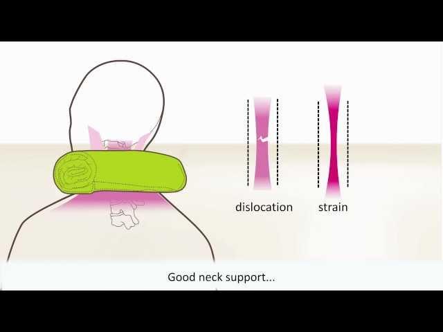 Whiplash - Symptoms and treatment